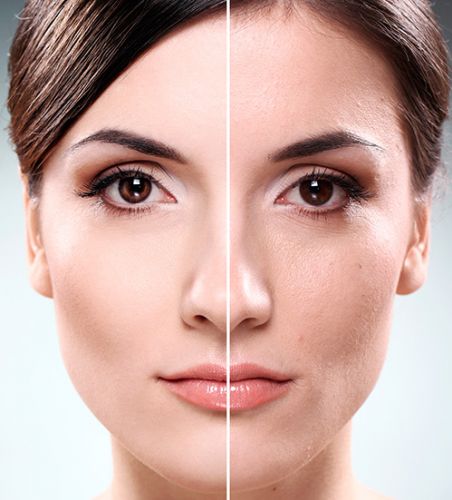 CURSO DE CLAREAMENTO DE PELE