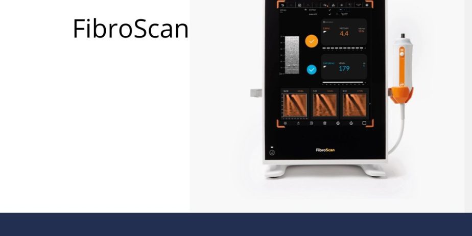 ASSISTÊNCIA-TÉCNICA-EM-FIBRO-SCAN-BRASIL